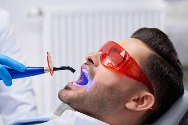 What Happens Inside Your Mouth During a 1 Hour Whitening Session Chelmsford